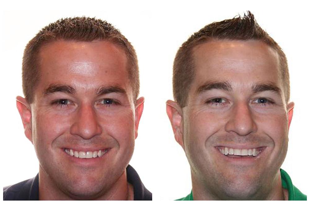 SmilePro Dental Care