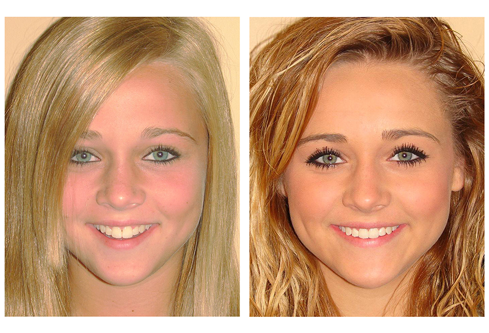 SmilePro Dental Care