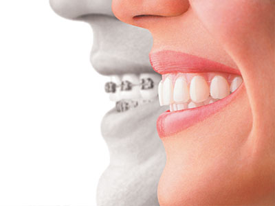 Invisalign Dental Office 77318