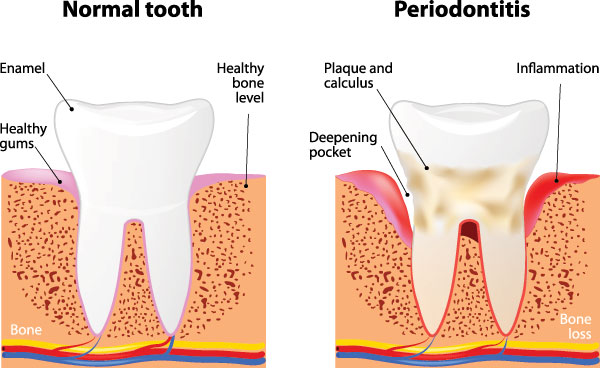 Periodontal Dentist 77318