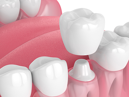 SmilePro Dental Care