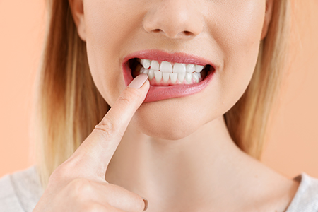 SmilePro Dental Care