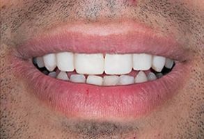 Dentist in Emerson