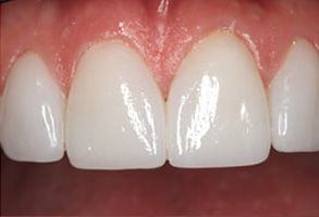 Cosmetic Dentist Emerson