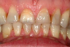 Dentist in Emerson