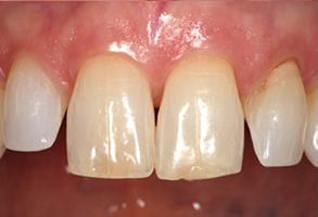 Emerson Cosmetic Dentist