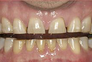 Dentist Emerson