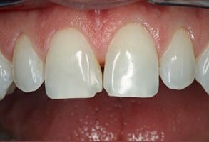Dentist near Emerson